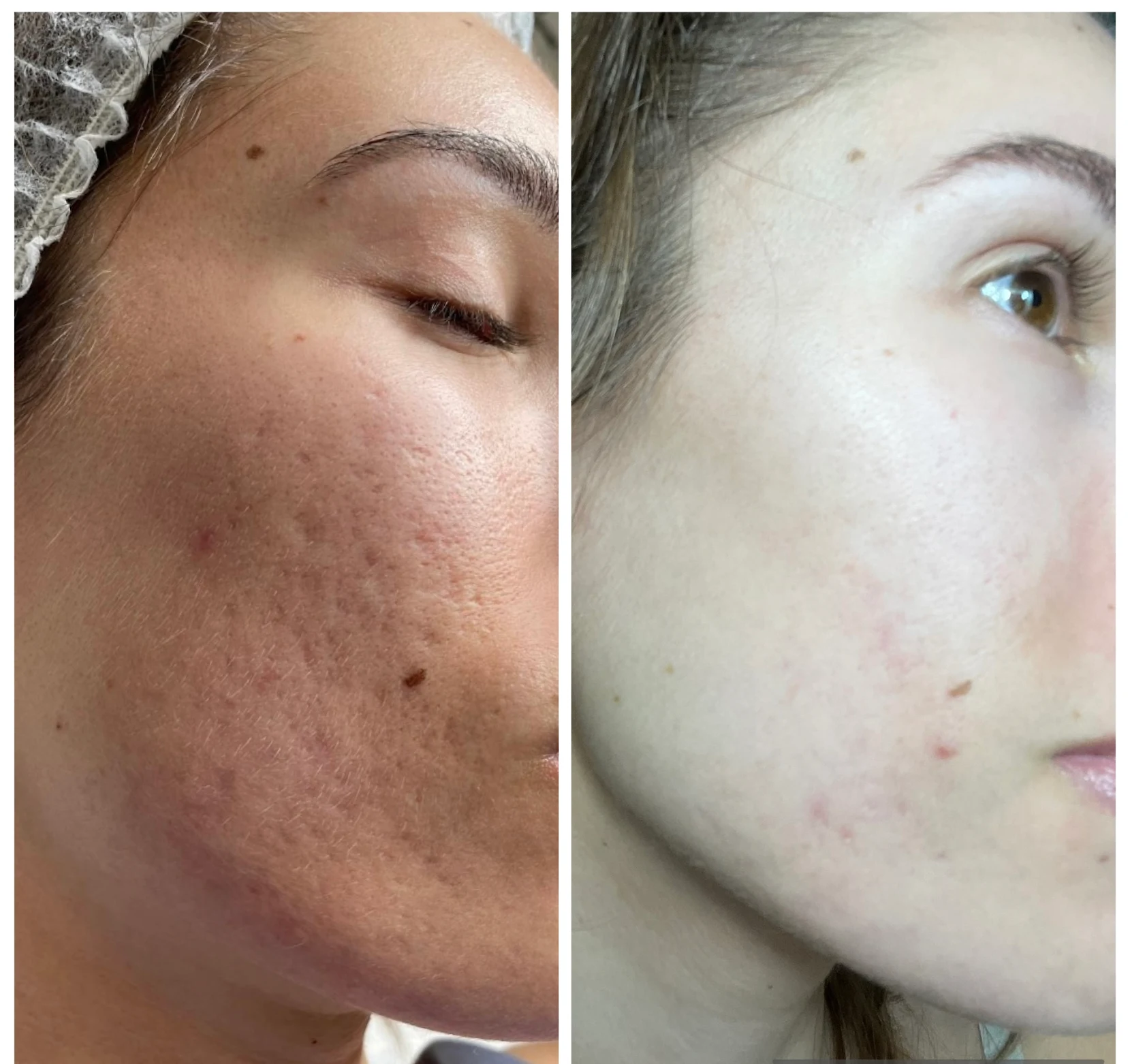 Tratamiento facial en Opulent Esthetic